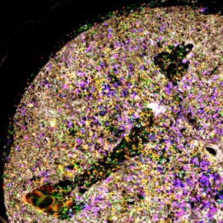 TMA core — multiplex immunofluorescence