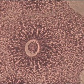 Organoid / spheroid core