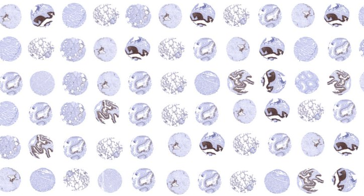 Galileo-built tissue microarray imaged by IHC