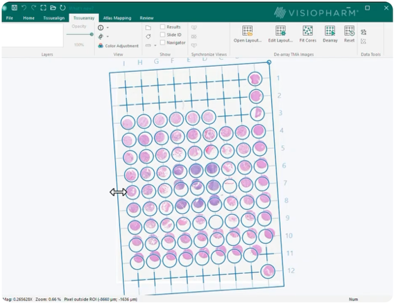 Visiopharm TissueArray interface